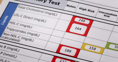 Kadar Kolesterol Normal Wanita Lansia