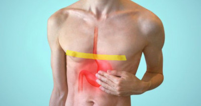 5 Ciri-ciri Lambung Bermasalah, Yuk Simak!