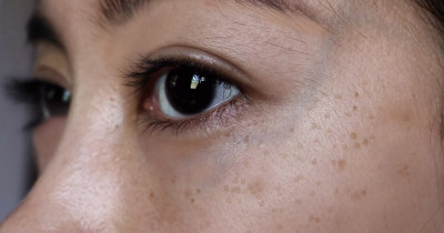 15 Rekomendasi Skincare untuk Menghilangkan Flek Hitam